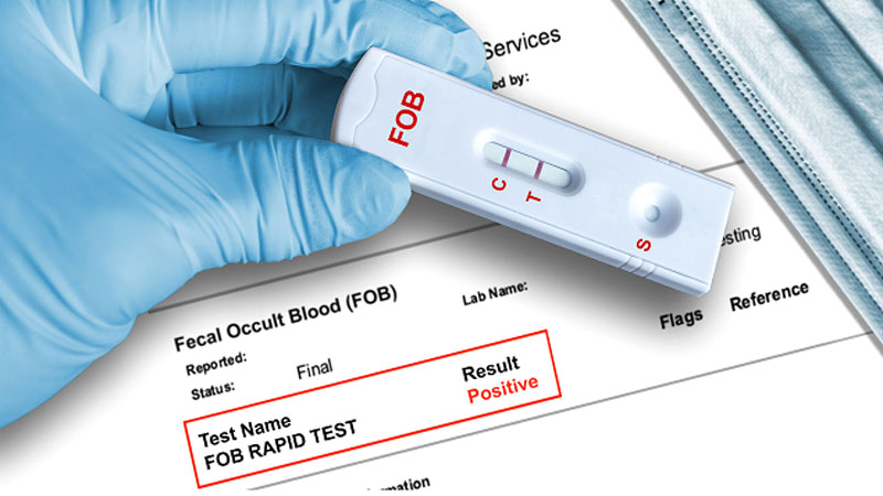 Στα 130.000 self test τα 1.000 βγήκαν θετικά για τον Καρκίνο του παχέος εντέρου